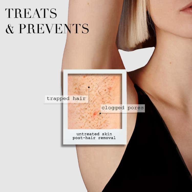 Kaia Naturals The Ingrown Bar